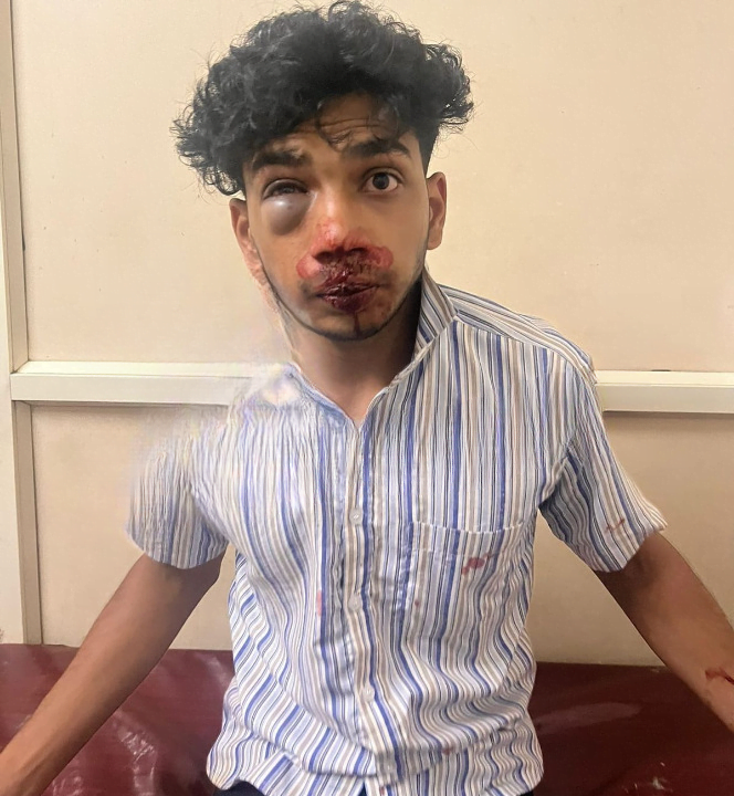 raging image_cleanup