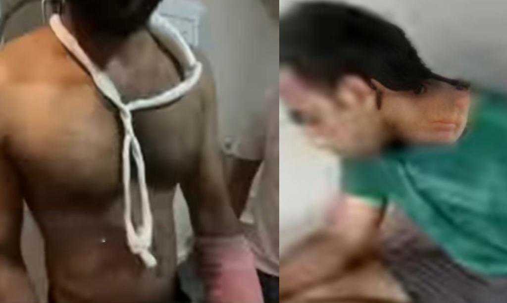 Koduvally kidnapped the youth and brutally beat him up image