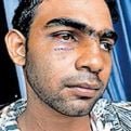 Three people were arrested in the incident of brutally beating a young man and leaving him on the road in koduvally. image