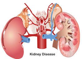 kidney disease image