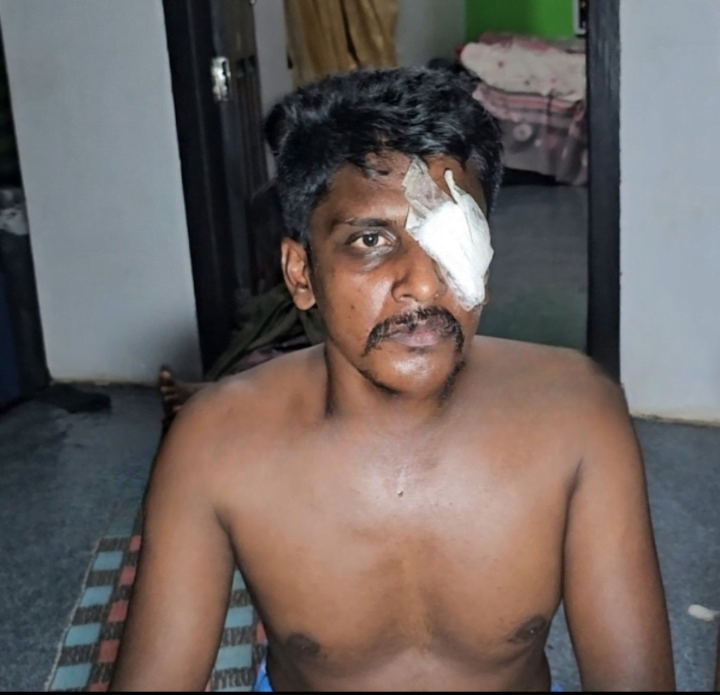 Thamarassery, ഓട്ടോറിക്ഷ ഹോൺ അടിച്ചെന്ന് അരോപിച്ച് മർദ്ദനം;രണ്ടു പേർക്കെതിരെ കേസെടുത്തു. 10 A case has been registered against two people who were allegedly assaulted for honking the autorickshaw horn. cleanup