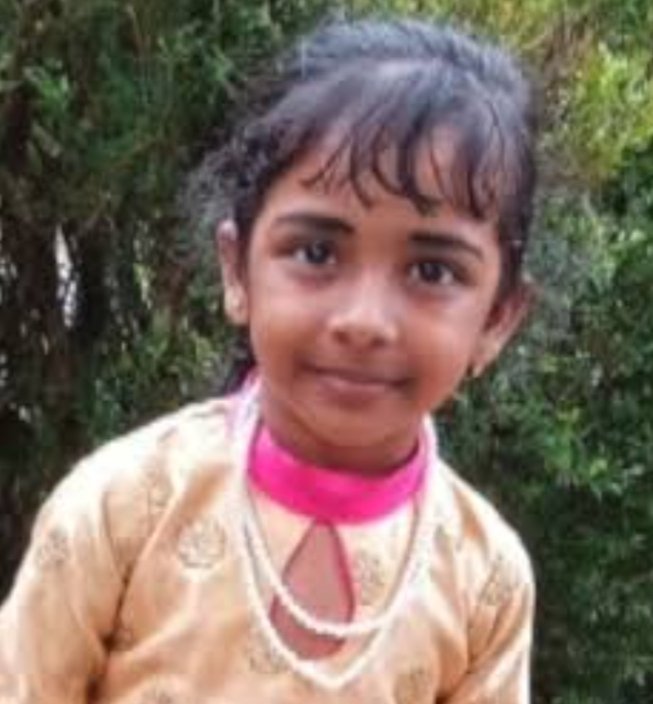 പേവിഷബാധയേറ്റ് Kozhikode Medical College ചികിത്സയിലായിരുന്ന അഞ്ച് വയസുകാരി മരിച്ചു 4 five year old girl undergoing treatment for rabies at kozhikode medical college dies