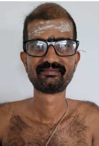 gold necklace stolen from temple idol kozhikode melsanthi arrested