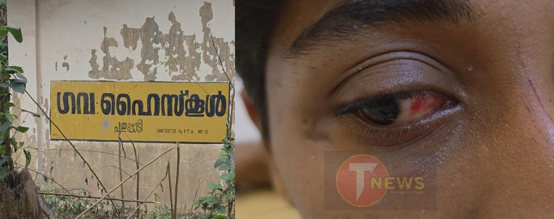 shahabas-model-assault-in-puthuppady-14-year-old-brutally-beaten-four-students-suspended